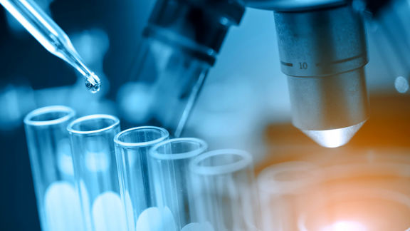 Ethylene: Up in Asia &  Europe,Down in US