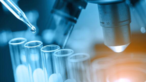 Ethylene: Up in Asia &  Europe,Down in US