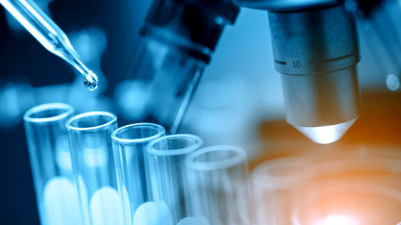Ethylene: Up in Asia &  Europe,Down in US