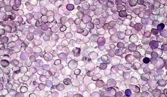 شکاف بزرگ قیمت پلی اتیلن ایران و خاورمیانه